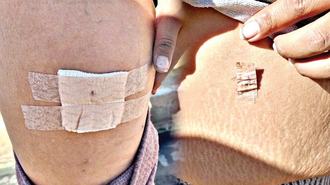 Cochabamba: Pareja apuñala a mujer en tentativa de feminicidio; detenido