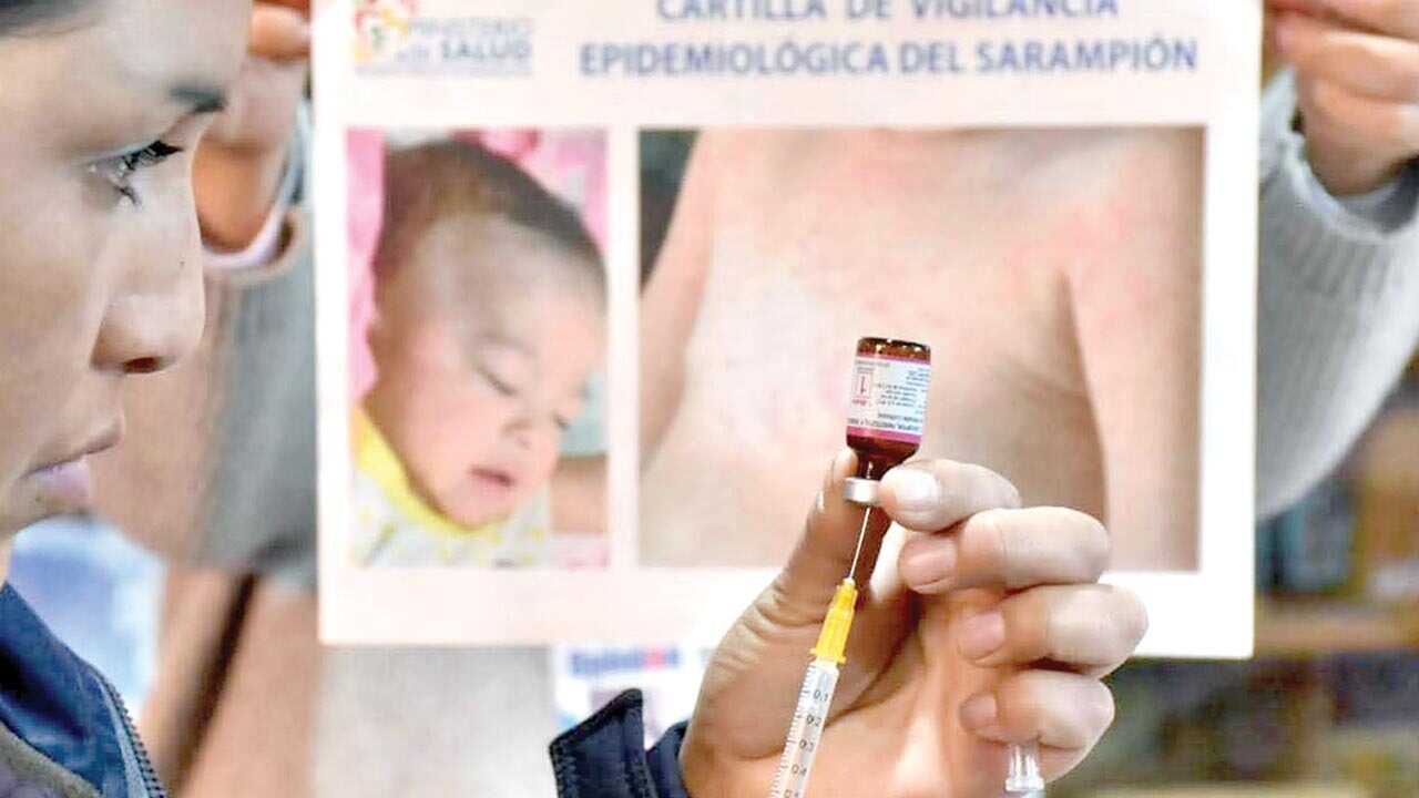 Tarija confirma 5 sarampiones y 45 sospechosos