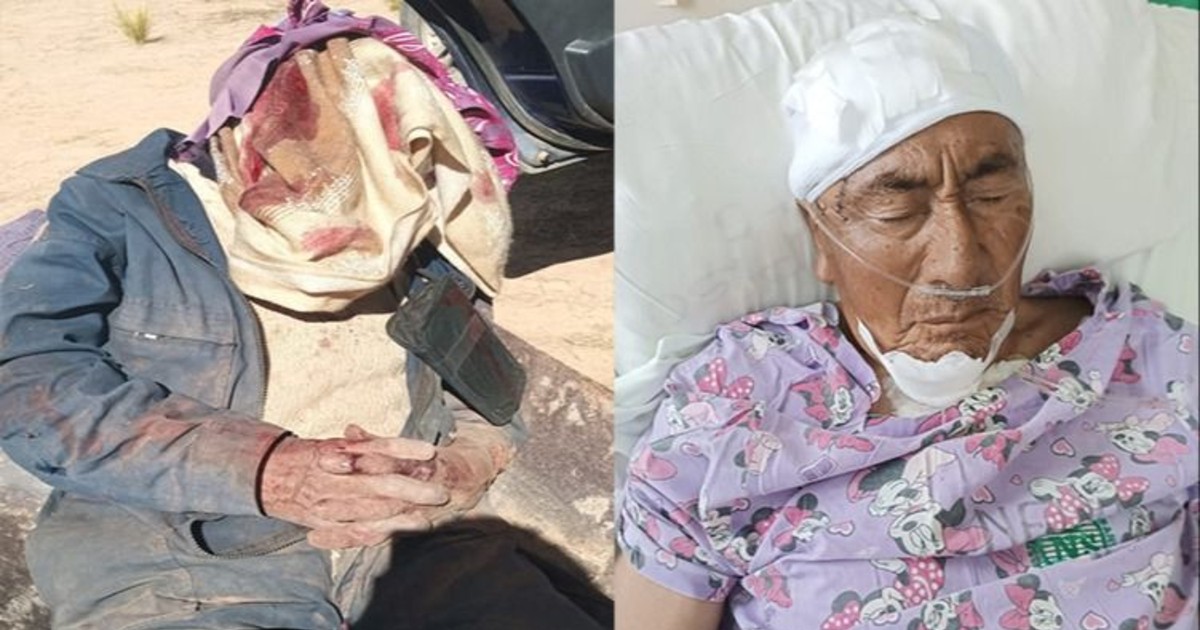 Buscan a hombre por brutal ataque con picota a su tío de 77 años