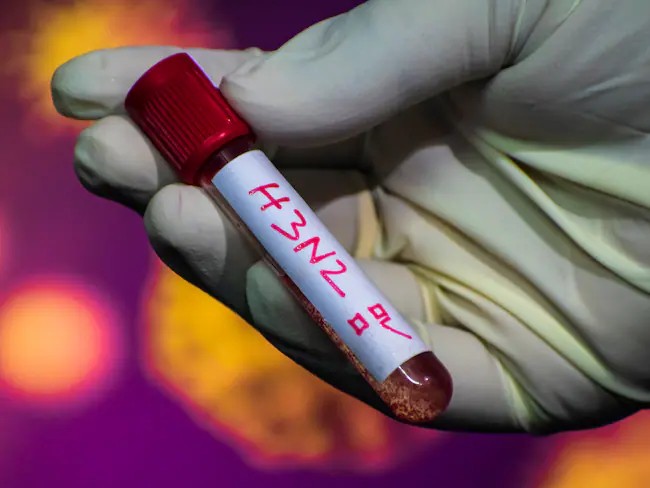 Sedes activa vigilancia epidemiológica en Santa Cruz tras brote de Gripe K