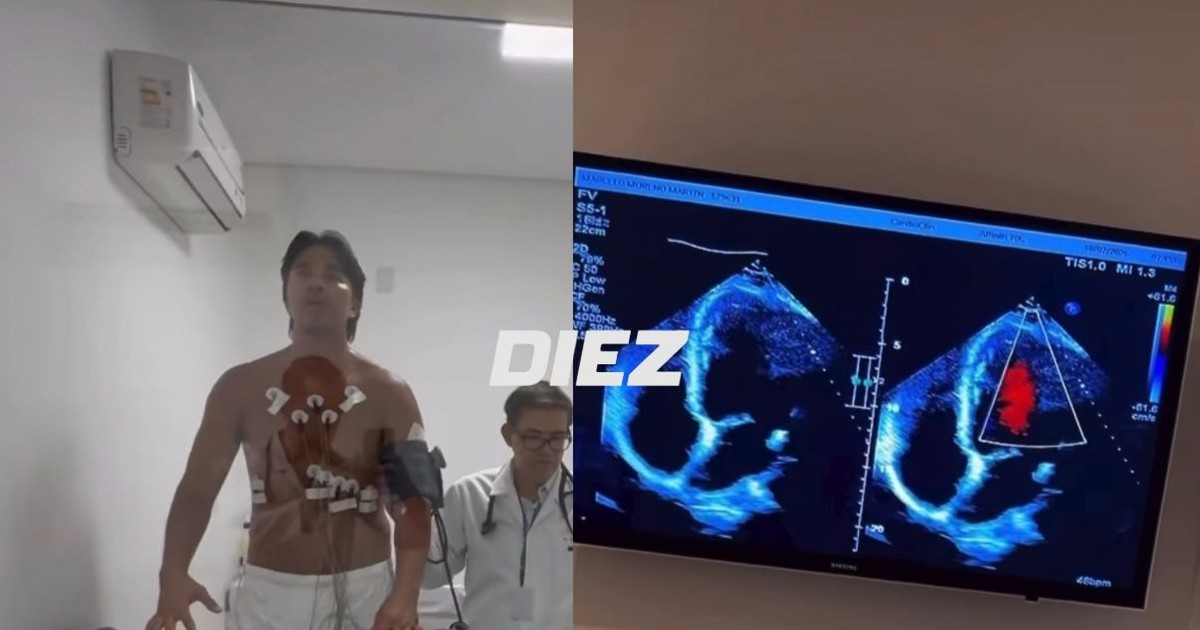 Marcelo Martins avanza en su retorno al fútbol con Bolívar en La Paz